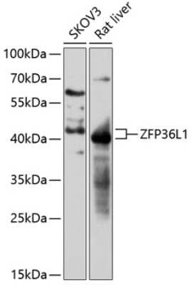 Western Blot: ZFP36L1 Antibody [NBP2-94828] - Western blot analysis of extracts of various cell lines, using ZFP36L1 antibody (NBP2-94828) at 1:3000 dilution. Secondary antibody: HRP Goat Anti-Rabbit IgG (H+L) at 1:10000 dilution. Lysates/proteins: 25ug per lane. Blocking buffer: 3% nonfat dry milk in TBST. Detection: ECL Basic Kit. Exposure time: 60s.